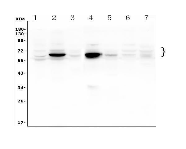 Anti-GLB1/Beta-galactosidase Antibody Picoband®