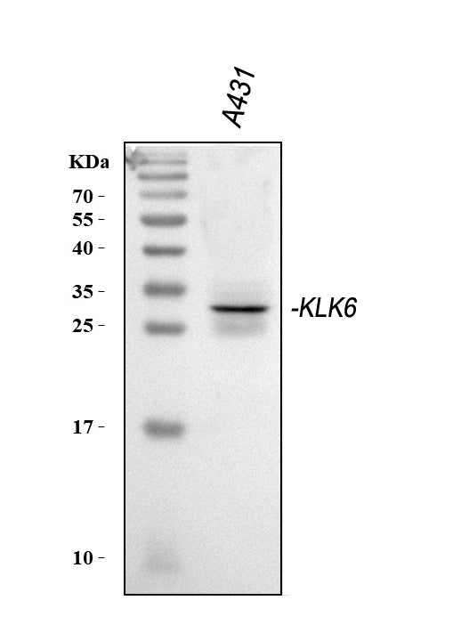 Anti-Kallikrein 6/KLK6 Antibody Picoband®