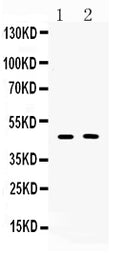 Anti-Protein C inhibitor/SERPINA5 Antibody Picoband®