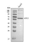 Anti-Glypican 3/GPC3 Antibody Picoband®