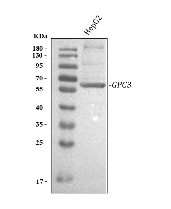 Anti-Glypican 3/GPC3 Antibody Picoband®