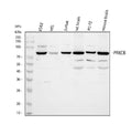 Anti-PKC beta 1/PRKCB Antibody Picoband®