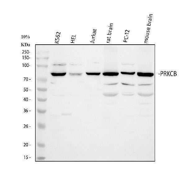Anti-PKC beta 1/PRKCB Antibody Picoband®