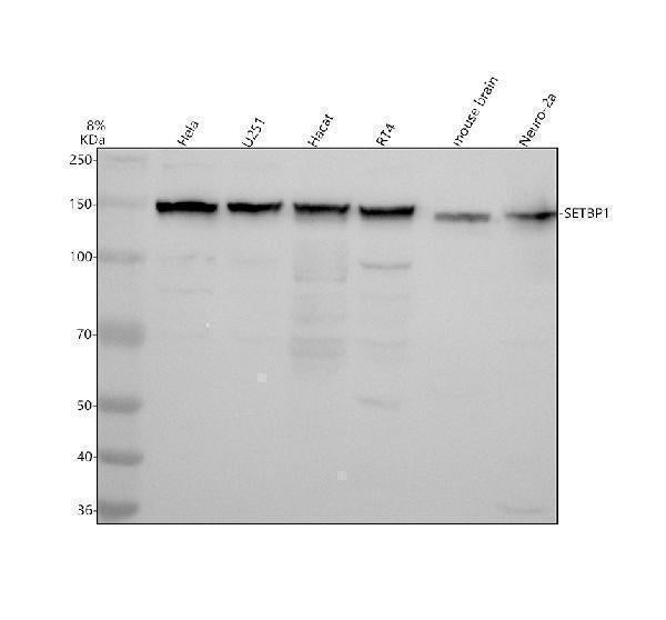 Anti-SETBP1 Antibody Picoband®