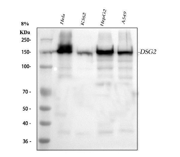 Anti-Desmoglein 2/DSG2 Antibody Picoband®