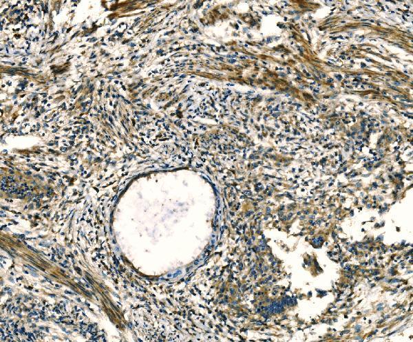 Anti-Apelin/APLN Antibody