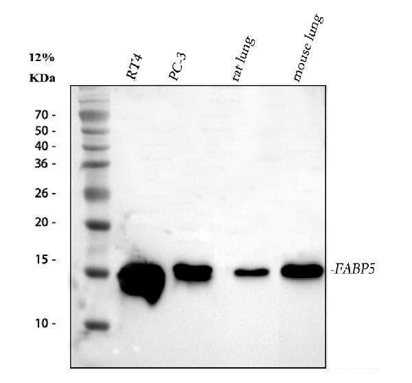 Anti-Fatty Acid Binding Protein 5/FABP5 Antibody Picoband®
