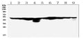 Anti-FH Antibody Picoband®