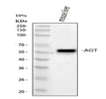 Anti-Angiotensinogen/AGT Antibody Picoband®