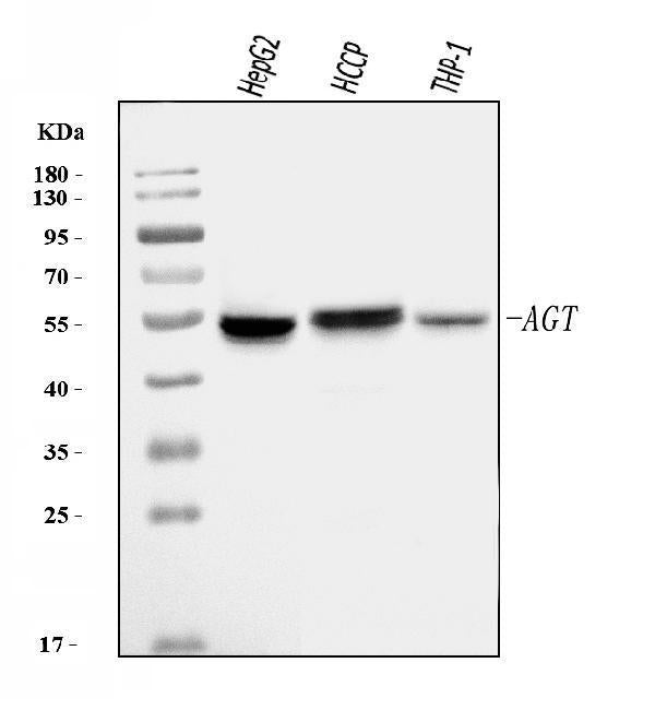 Anti-Angiotensinogen/AGT Antibody Picoband®