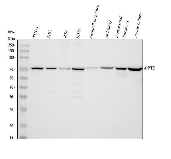 Anti-CPT2/CPT1 Antibody Picoband®