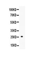 Anti-TREM1 Antibody Picoband®