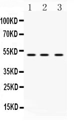 Anti-DR4/TNFRSF10A Antibody Picoband®