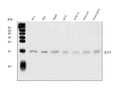 Anti-Acid phosphatase/ACP1 Antibody Picoband®