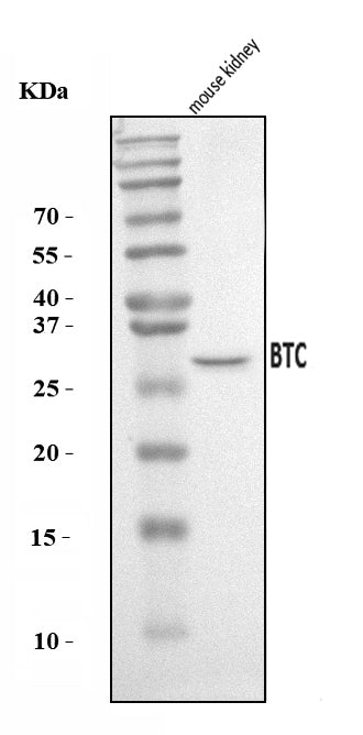 Anti-Btc Antibody Picoband®