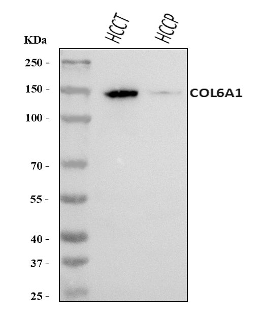 Anti-COL6A1 Antibody Picoband®