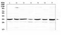 Anti-UCP2 Antibody Picoband®