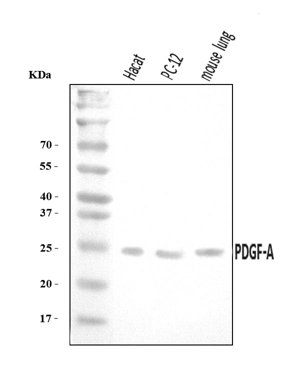 Anti-PDGF AA/PDGFA Antibody Picoband®
