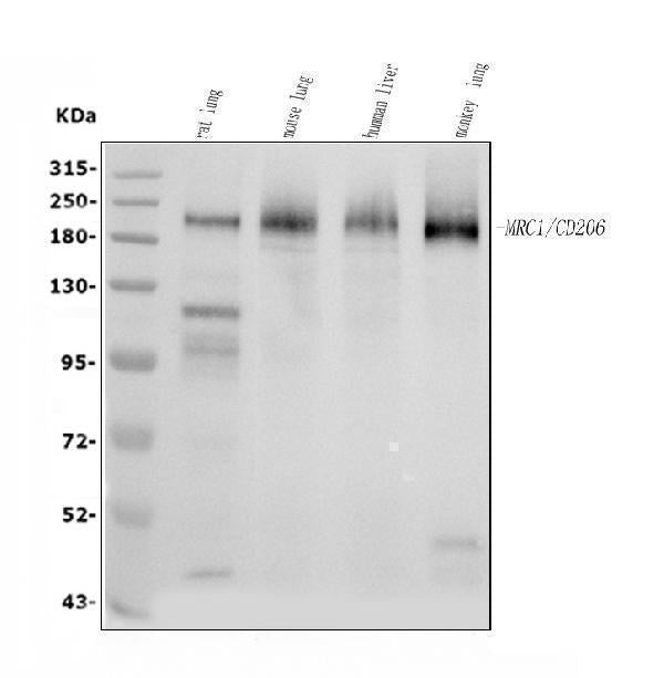 Anti-Mannose Receptor/MRC1 Picoband® Antibody