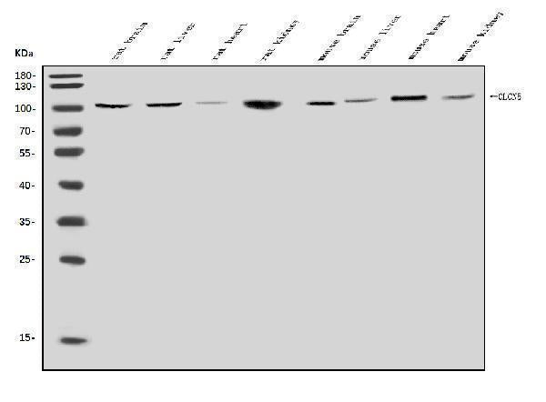 Anti-ClC-5/CLCN5 Antibody Picoband®