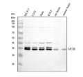 Anti-MC2 receptor/MC2R Antibody Picoband®