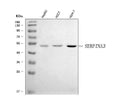Anti-AACT/SERPINA3 Antibody Picoband®