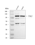 Anti-ACK1/TNK2 Antibody Picoband®
