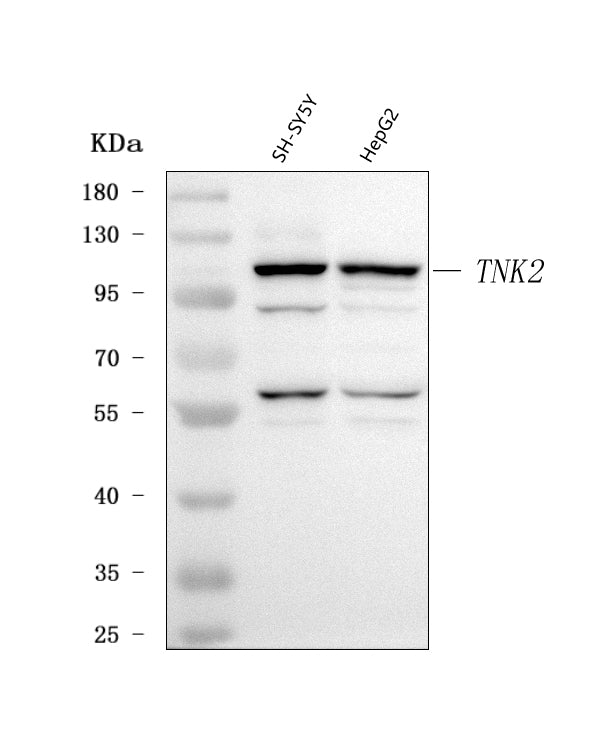 Anti-ACK1/TNK2 Antibody Picoband®