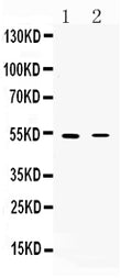Anti-Nicotinic Acetylcholine Receptor alpha 5/CHRNA5 Antibody Picoband®