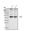 Anti-GABA A Receptor gamma 2/GABRG2 Antibody Picoband®