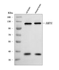 Anti-Amphiphysin/AMPH Antibody Picoband®