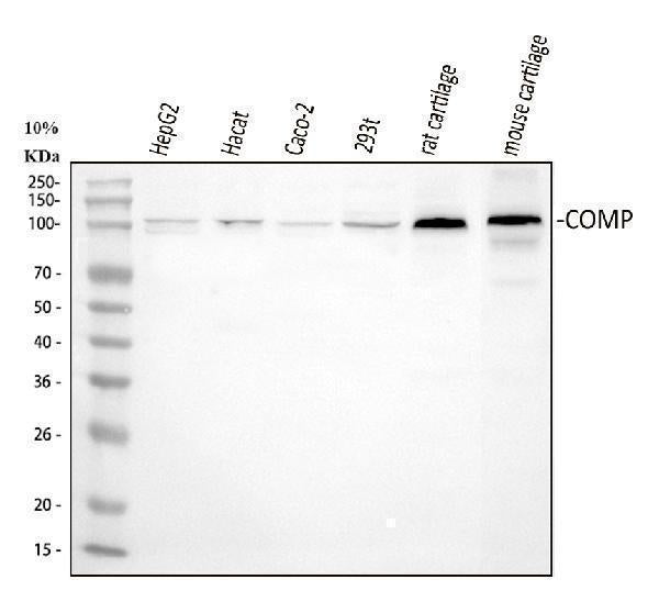 Anti-COMP Antibody Picoband®