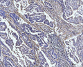 Anti-COL4A2 Antibody