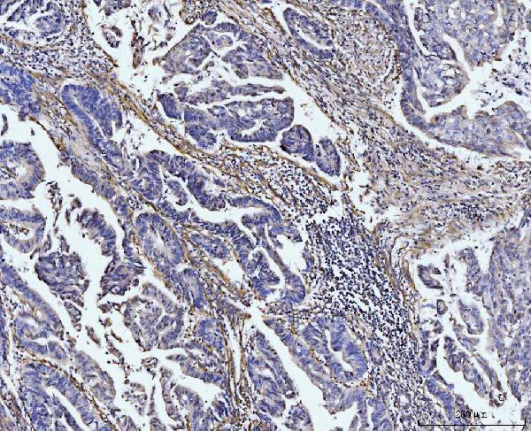 Anti-COL4A2 Antibody