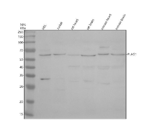 Anti-PLAG1 Antibody Picoband®