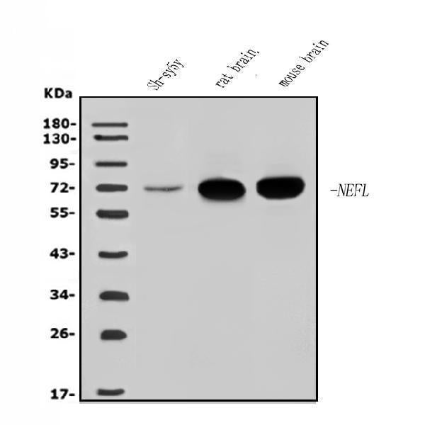 Anti-NEFL/NF-L Antibody Picoband®