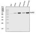 Anti-ALAS2/ASB Antibody Picoband®
