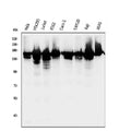 Anti-RNA Helicase A/DHX9 Antibody Picoband®