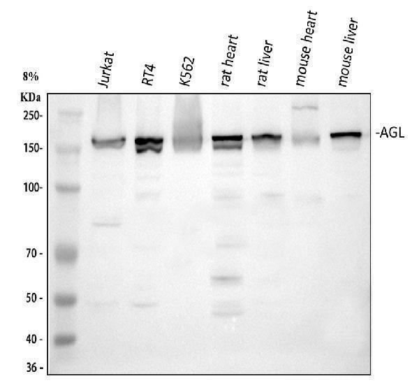 Anti-AGL Antibody Picoband®