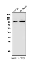 Anti-PDE6 beta/PDE6B Antibody Picoband®