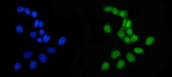 Anti-APRT Antibody Picoband®