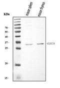 Anti-Dectin-1/Clec7a Antibody Picoband®