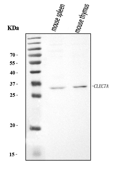 Anti-Dectin-1/Clec7a Antibody Picoband®
