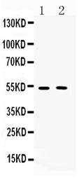 Anti-Muscarinic Acetylcholine Receptor 2/CHRM2 Antibody Picoband®