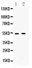 Anti-Muscarinic Acetylcholine Receptor 2/CHRM2 Antibody Picoband®