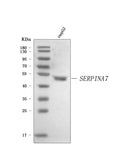 Anti-Thyroxine Binding Globulin/SERPINA7 Antibody Picoband®