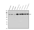 Anti-Aconitase 1/ACO1 Antibody Picoband®