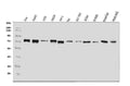 Anti-ADAMTS5 Antibody Picoband®