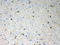 Anti-HCN2 Antibody Picoband®