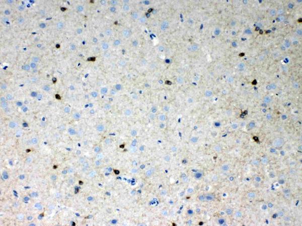 Anti-HCN2 Antibody Picoband®